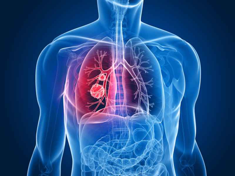 Age of Donor Affects Stem Cell Effectiveness in Repairing Lung Damage from Pulmonary Fibrosis