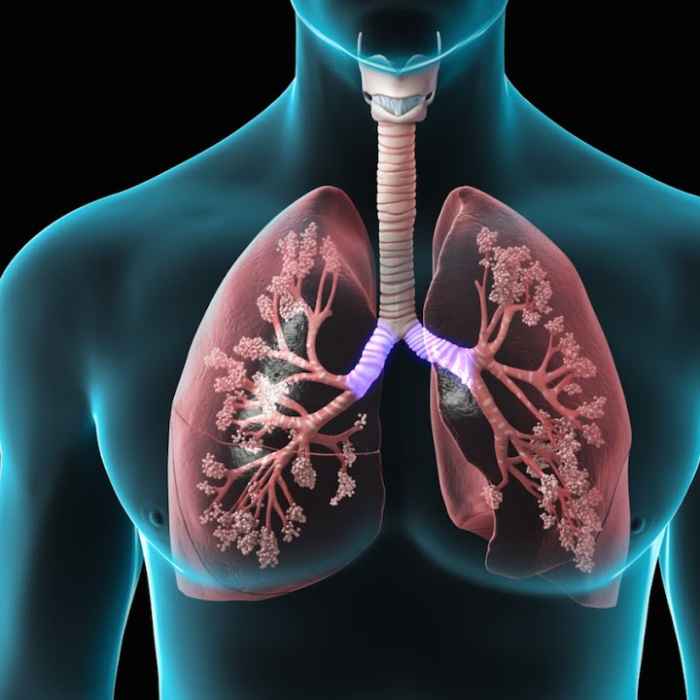 COPD | Stemaid™ : Pluripotent Stem Cells